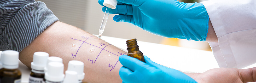 ALLERGY TESTING